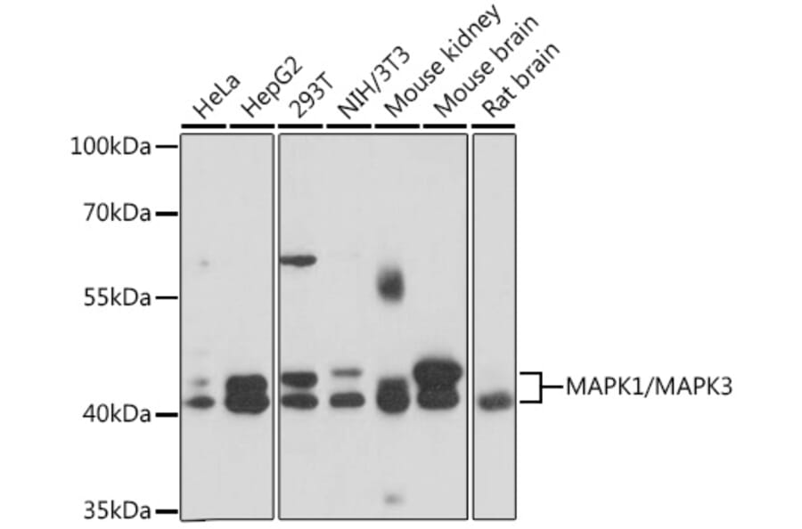Western Blot - Anti-ERK1 + ERK2 Antibody (A92634) - Antibodies.com