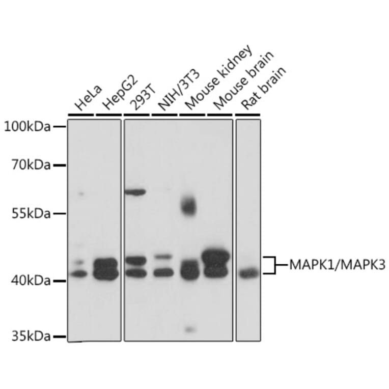 Western Blot - Anti-ERK1 + ERK2 Antibody (A92634) - Antibodies.com