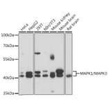 Western Blot - Anti-ERK1 + ERK2 Antibody (A92634) - Antibodies.com