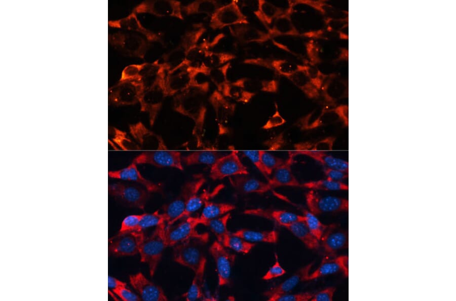 Immunofluorescence - Anti-ERK1 + ERK2 Antibody (A92634) - Antibodies.com