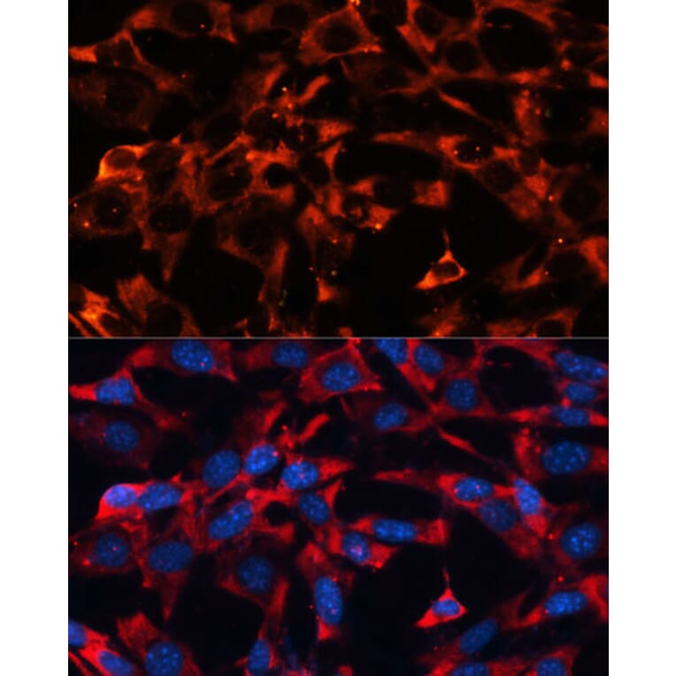 Immunofluorescence - Anti-ERK1 + ERK2 Antibody (A92634) - Antibodies.com