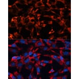 Immunofluorescence - Anti-ERK1 + ERK2 Antibody (A92634) - Antibodies.com