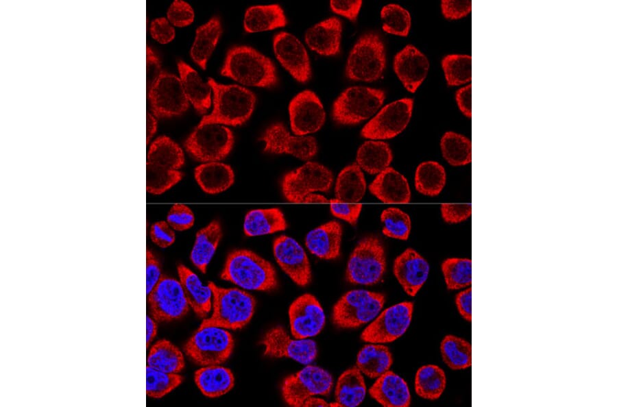Immunofluorescence - Anti-ERK1 + ERK2 Antibody (A92634) - Antibodies.com