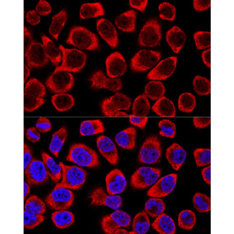 Immunofluorescence - Anti-ERK1 + ERK2 Antibody (A92634) - Antibodies.com