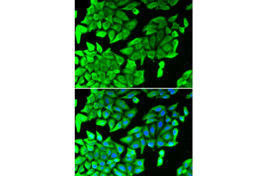 Immunofluorescence - Anti-JNK1 Antibody (A2985) - Antibodies.com
