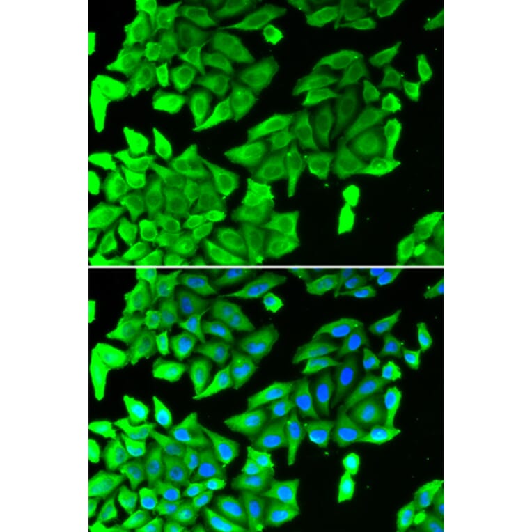 Immunofluorescence - Anti-JNK1 Antibody (A2985) - Antibodies.com