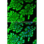 Immunofluorescence - Anti-JNK1 Antibody (A2985) - Antibodies.com