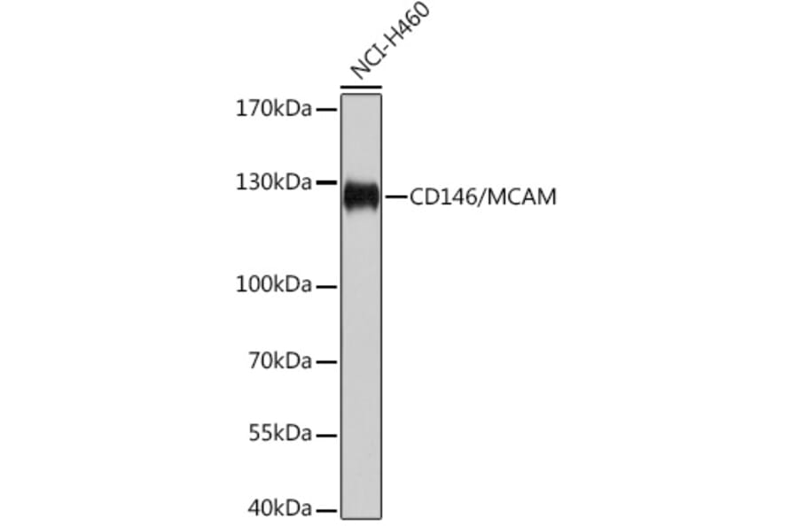 Western Blot - Anti-CD146 Antibody (A92639) - Antibodies.com