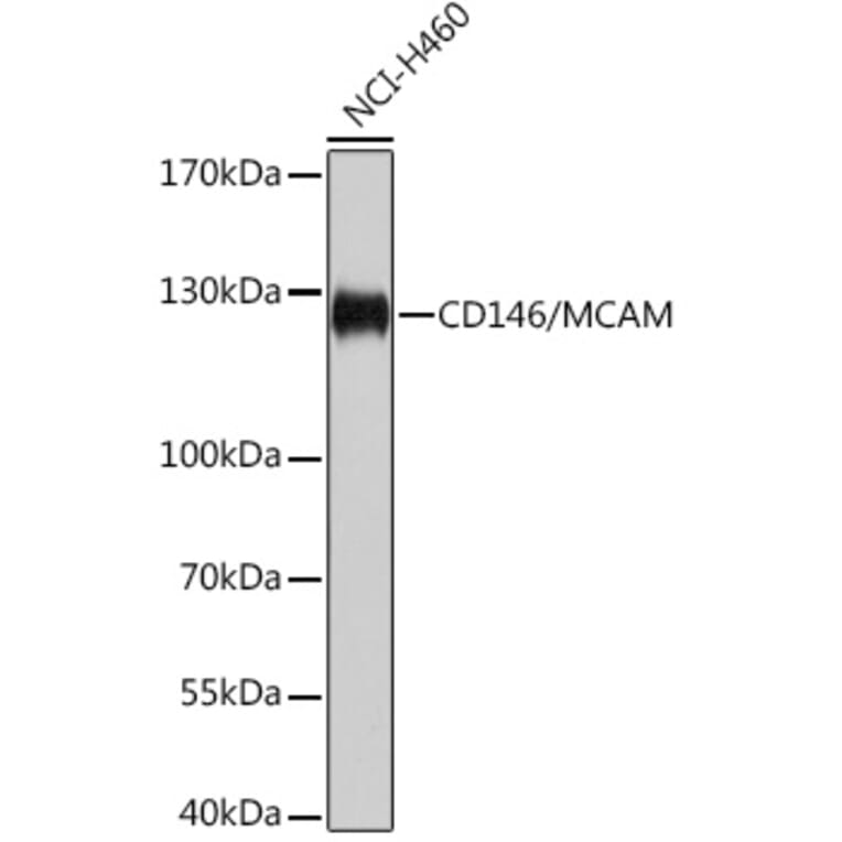Western Blot - Anti-CD146 Antibody (A92639) - Antibodies.com