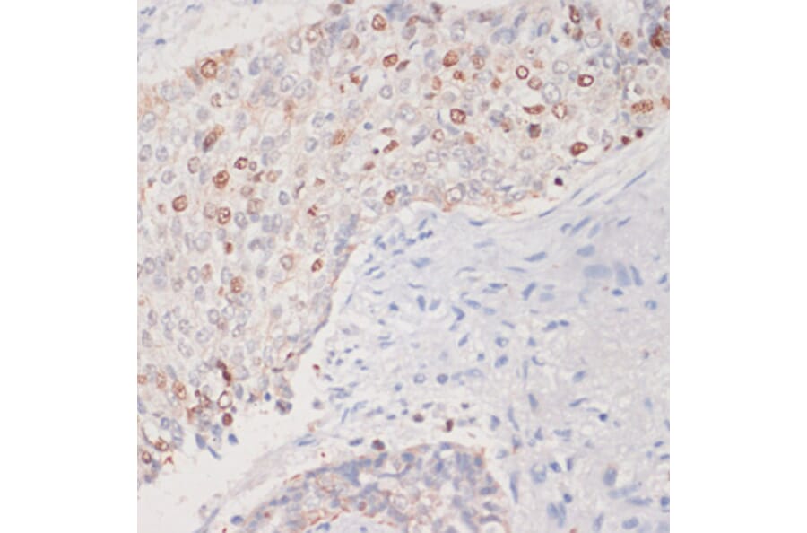 Immunohistochemistry - Anti-MKI67 Antibody (A17341) - Antibodies.com