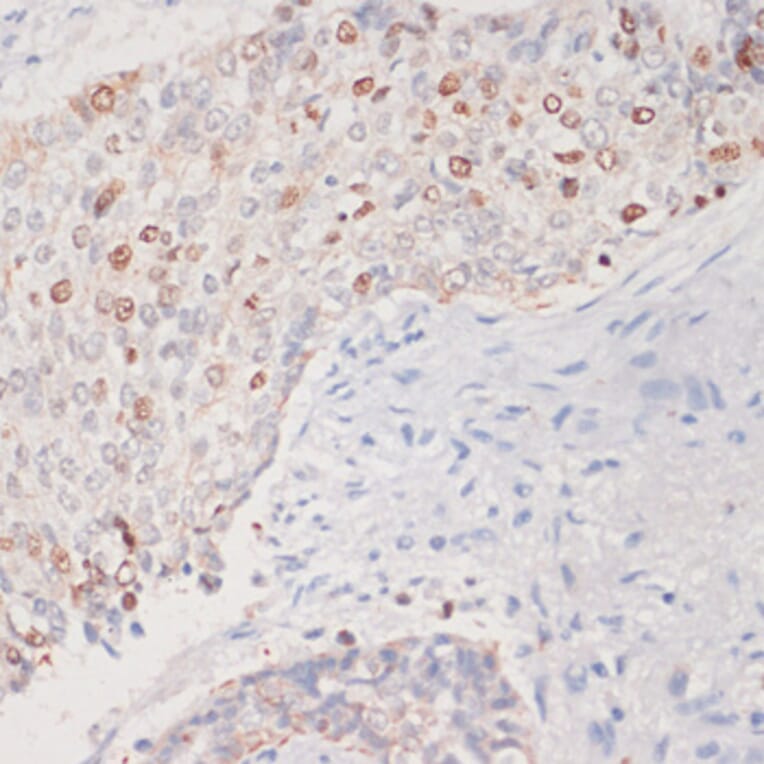 Immunohistochemistry - Anti-MKI67 Antibody (A17341) - Antibodies.com