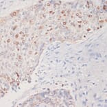 Immunohistochemistry - Anti-MKI67 Antibody (A17341) - Antibodies.com