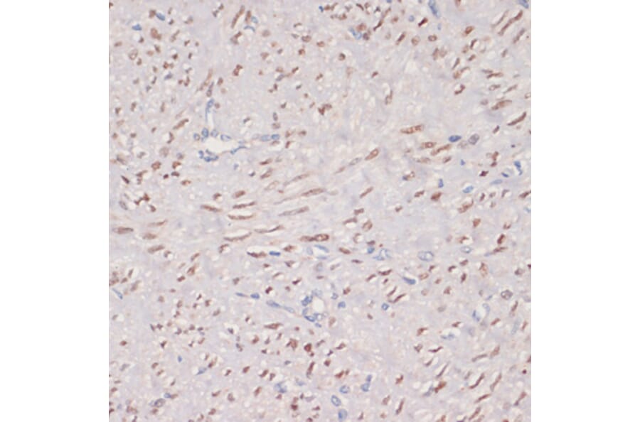 Immunohistochemistry - Anti-MKI67 Antibody (A17341) - Antibodies.com