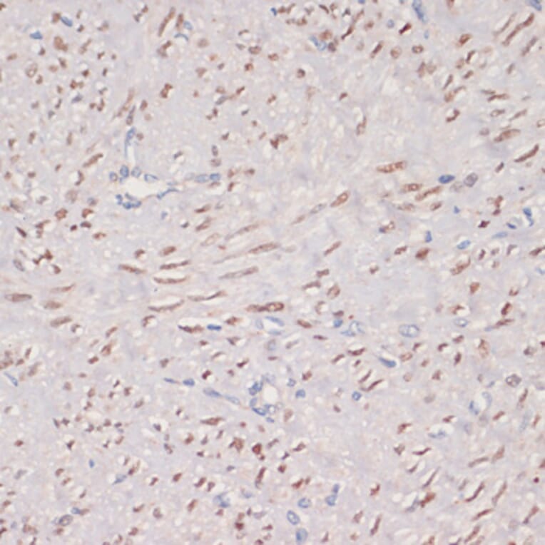 Immunohistochemistry - Anti-MKI67 Antibody (A17341) - Antibodies.com