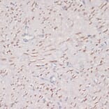 Immunohistochemistry - Anti-MKI67 Antibody (A17341) - Antibodies.com