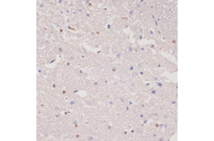 Immunohistochemistry - Anti-MKI67 Antibody (A17341) - Antibodies.com