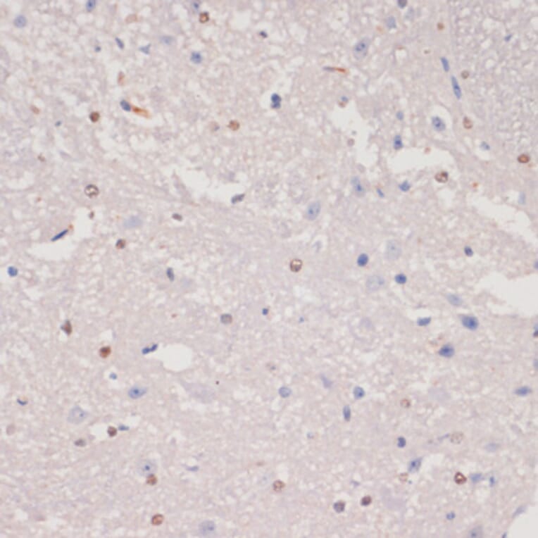 Immunohistochemistry - Anti-MKI67 Antibody (A17341) - Antibodies.com