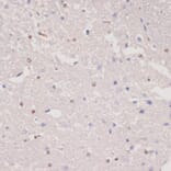 Immunohistochemistry - Anti-MKI67 Antibody (A17341) - Antibodies.com