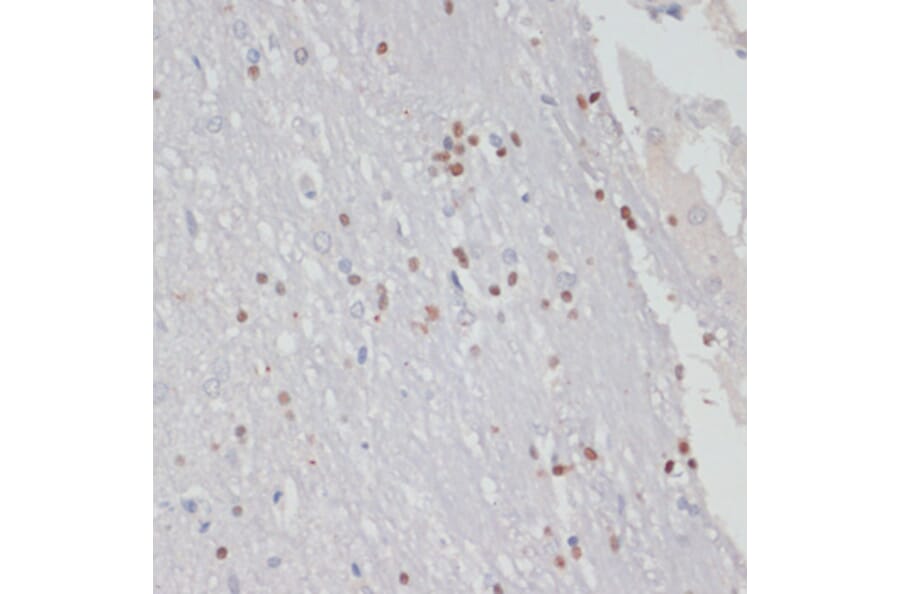 Immunohistochemistry - Anti-MKI67 Antibody (A17341) - Antibodies.com