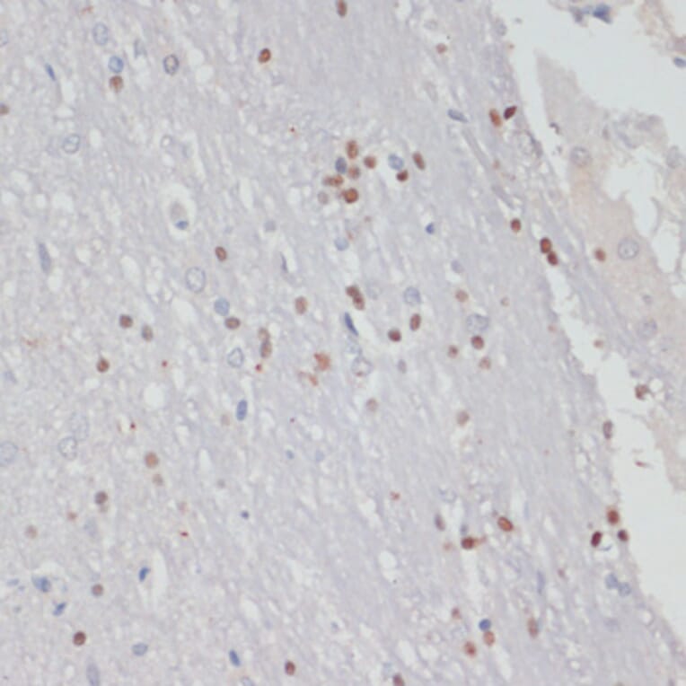 Immunohistochemistry - Anti-MKI67 Antibody (A17341) - Antibodies.com