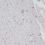 Immunohistochemistry - Anti-MKI67 Antibody (A17341) - Antibodies.com