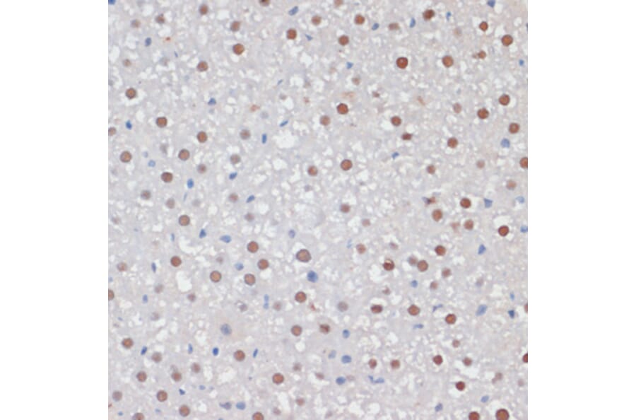 Immunohistochemistry - Anti-MKI67 Antibody (A17341) - Antibodies.com
