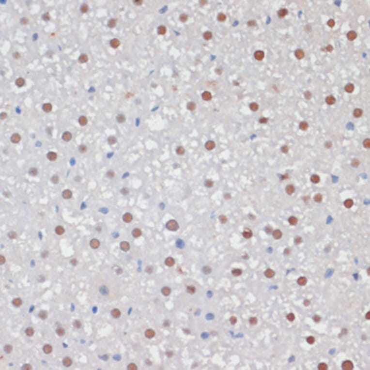 Immunohistochemistry - Anti-MKI67 Antibody (A17341) - Antibodies.com