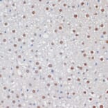 Immunohistochemistry - Anti-MKI67 Antibody (A17341) - Antibodies.com