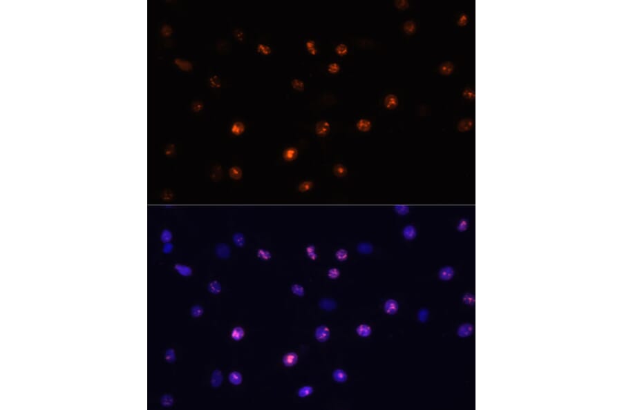 Immunofluorescence - Anti-MKI67 Antibody (A17341) - Antibodies.com