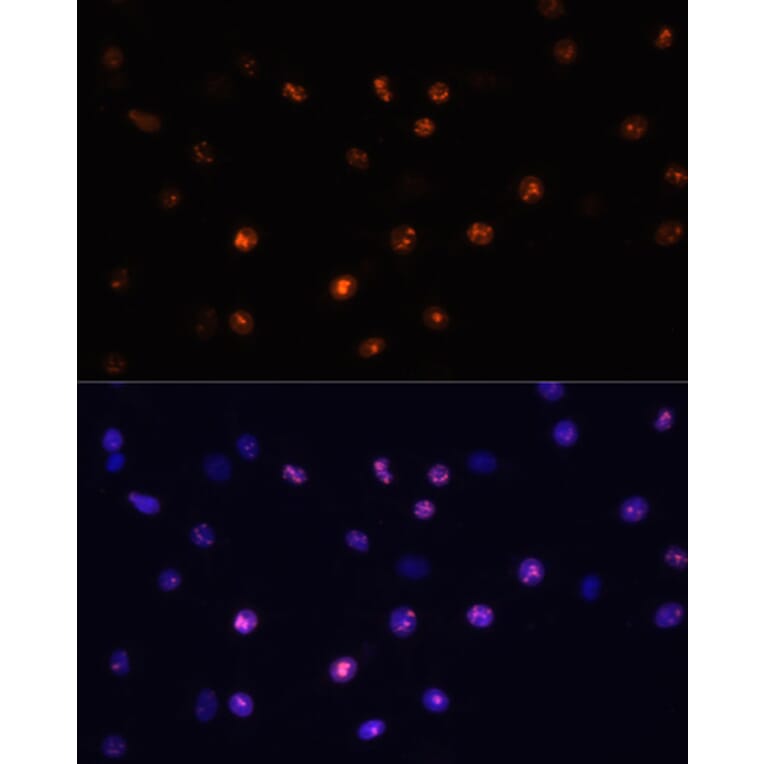 Immunofluorescence - Anti-MKI67 Antibody (A17341) - Antibodies.com