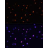 Immunofluorescence - Anti-MKI67 Antibody (A17341) - Antibodies.com