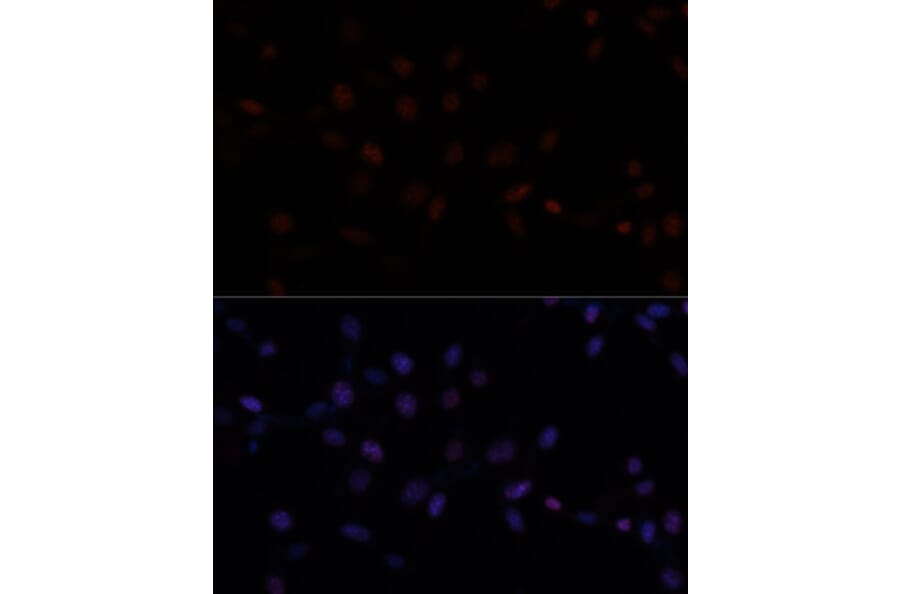 Immunofluorescence - Anti-MKI67 Antibody (A17341) - Antibodies.com