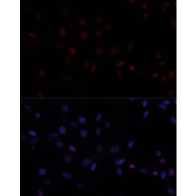 Immunofluorescence - Anti-MKI67 Antibody (A17341) - Antibodies.com