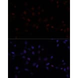 Immunofluorescence - Anti-MKI67 Antibody (A17341) - Antibodies.com