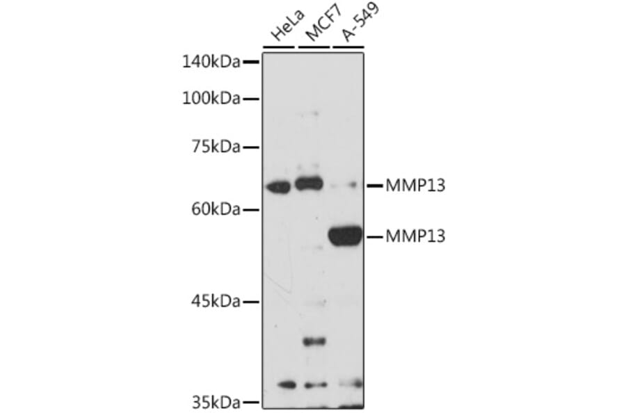 Western Blot - Anti-MMP13 Antibody (A92641) - Antibodies.com