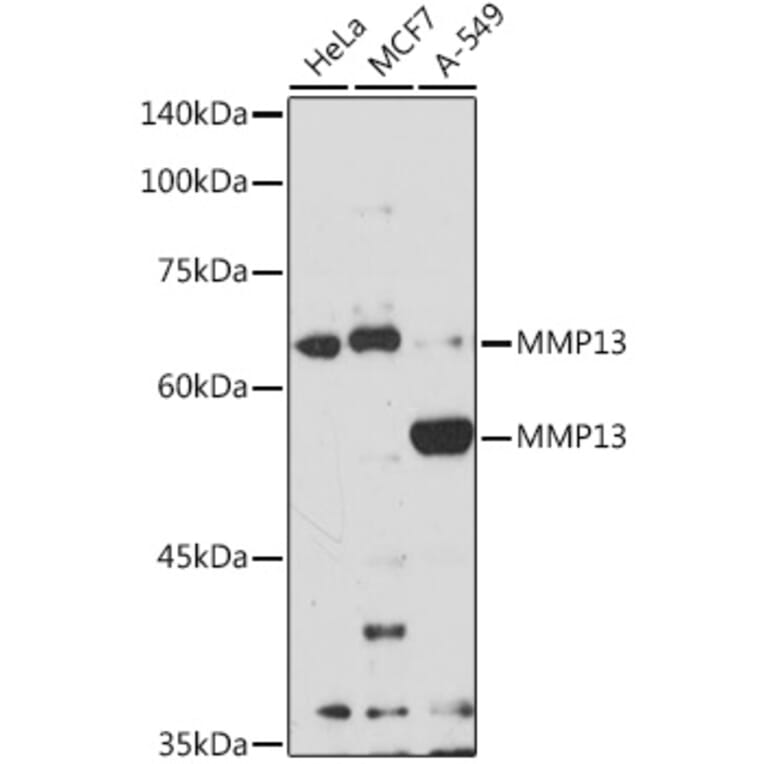 Western Blot - Anti-MMP13 Antibody (A92641) - Antibodies.com
