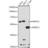 Western Blot - Anti-MMP13 Antibody (A92641) - Antibodies.com