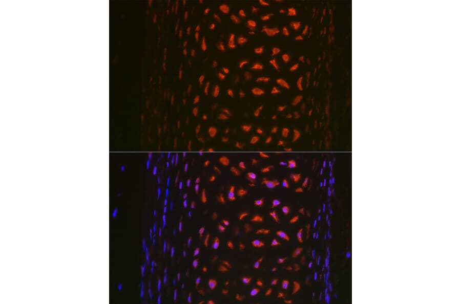 Immunofluorescence - Anti-MMP13 Antibody (A92641) - Antibodies.com