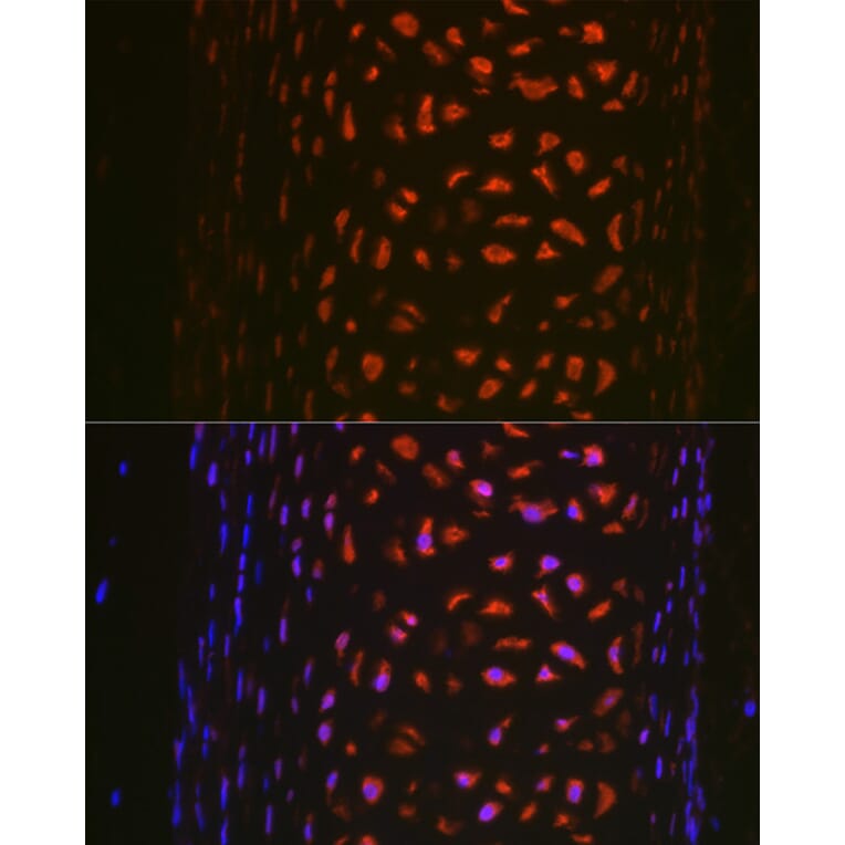 Immunofluorescence - Anti-MMP13 Antibody (A92641) - Antibodies.com