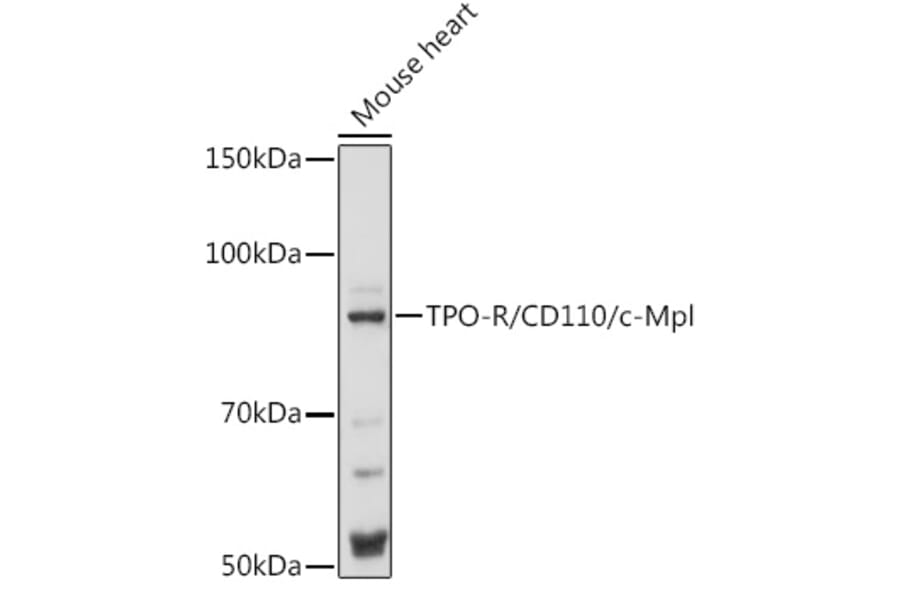 Western Blot - Anti-TPOR/MPL Antibody (A92642) - Antibodies.com