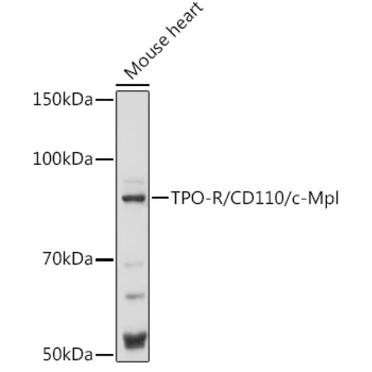 Western Blot - Anti-TPOR/MPL Antibody (A92642) - Antibodies.com