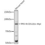 Western Blot - Anti-TPOR/MPL Antibody (A92642) - Antibodies.com