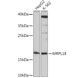 Western Blot - Anti-MRPL18 Antibody (A92644) - Antibodies.com