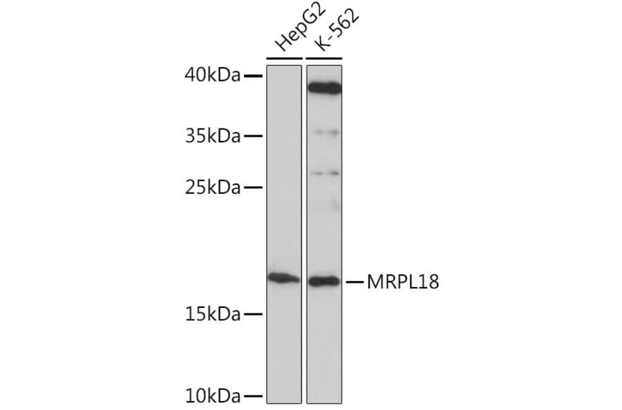Western Blot - Anti-MRPL18 Antibody (A92644) - Antibodies.com