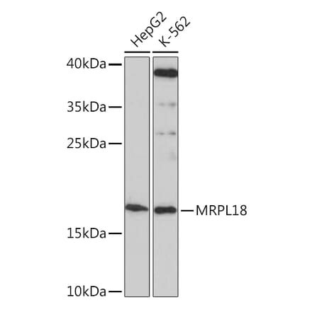 Western Blot - Anti-MRPL18 Antibody (A92644) - Antibodies.com