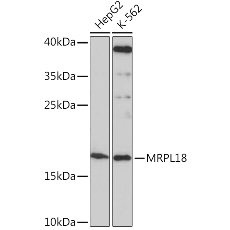 Western Blot - Anti-MRPL18 Antibody (A92644) - Antibodies.com