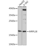 Western Blot - Anti-MRPL18 Antibody (A92644) - Antibodies.com