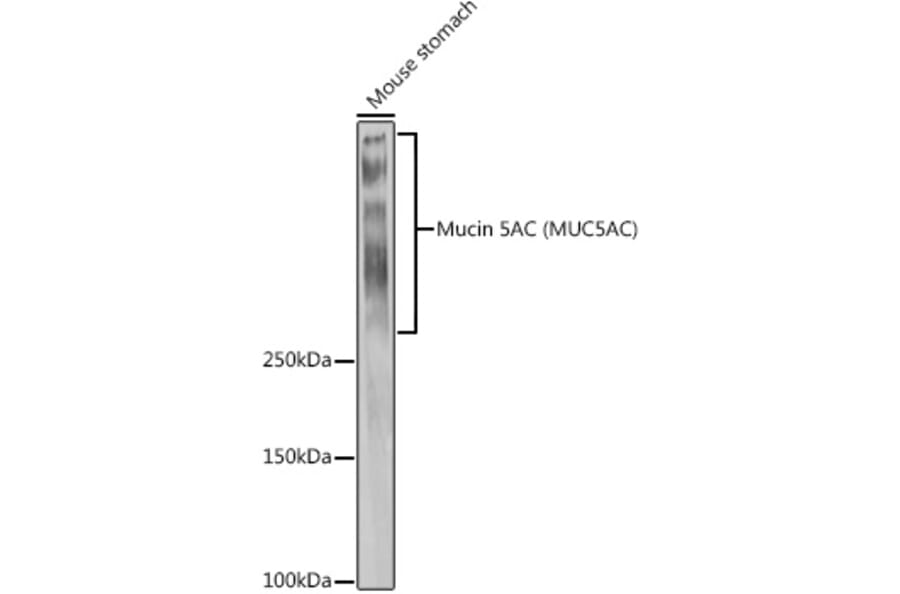 Western Blot - Anti-Mucin 5AC Antibody (A92648) - Antibodies.com