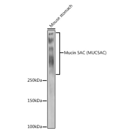 Western Blot - Anti-Mucin 5AC Antibody (A92648) - Antibodies.com
