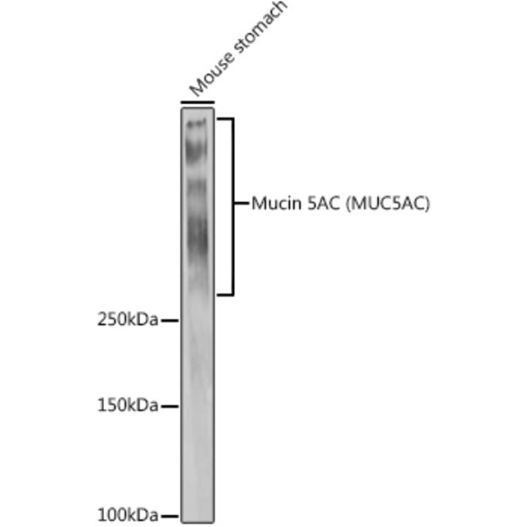 Western Blot - Anti-Mucin 5AC Antibody (A92648) - Antibodies.com